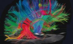 Miłość jest jak narkotyk