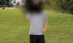 Zwyrodnienie plamki związane z wiekiem