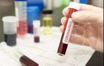 30 przypadek zakażenia koronawirusem na Podkarpaciu