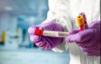 5 068 nowych zachorowań w Polsce, 391 na Podkarpaciu, 56 w Rzeszowie