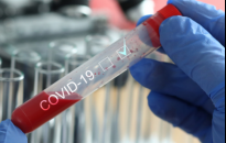 Na Podkarpaciu aż 93 proc. testów pozytywnych -  w ciągu ostatniej doby 