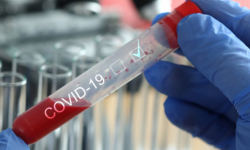 Na Podkarpaciu aż 93 proc. testów pozytywnych -  w ciągu ostatniej doby 