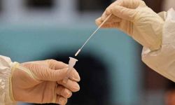 382 nowe zakażenia koronawirusem, zmarły 84 osoby