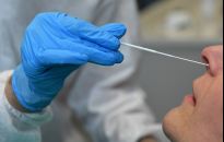 W Polsce stwierdzono trzy przypadki zakażenia wariantem Lambda