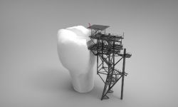 Korony cyrkonowe, a porcelanowe - jakie wybrać?