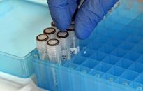 MZ: 264 zakażenia koronawirusem, zmarło 6 osób z COVID-19