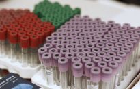 Ministerstwo Zdrowia: od 16 do 22 czerwca wykryto 1341 zakażeń, zmarło 17 osób z COVID-19