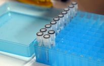 912 zakażeń koronawirusem. Zmarło 13 osób z COVID-19