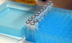 912 zakażeń koronawirusem. Zmarło 13 osób z COVID-19